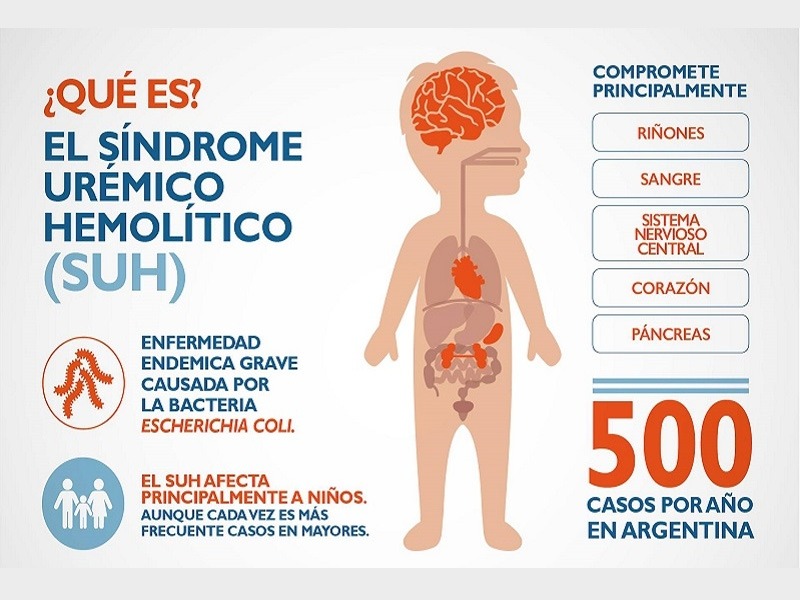 El IPCVA recomienda prácticas responsables para la prevención del Síndrome Urémico Hemolítico (SUH)