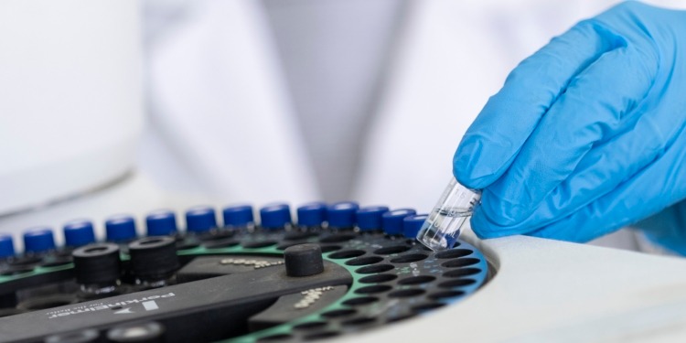 Un organismo internacional destacó al INTI por sus análisis de calidad en aceite de oliva